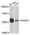 Phosphoglycerate Dehydrogenase antibody, STJ24981, St John