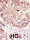 Homeodomain Interacting Protein Kinase 3 antibody, 62-973, ProSci, Immunofluorescence image 