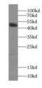 p50 dynamitin antibody, FNab02581, FineTest, Western Blot image 