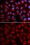 Erythrocyte Membrane Protein Band 4.1 antibody, GTX54005, GeneTex, Immunocytochemistry image 