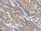 CRK Like Proto-Oncogene, Adaptor Protein antibody, CSB-PA129519, Cusabio, Immunohistochemistry paraffin image 