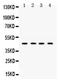 Nuclear Receptor Subfamily 2 Group F Member 2 antibody, PB9729, Boster Biological Technology, Western Blot image 