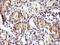 HERP1 antibody, M04908, Boster Biological Technology, Immunohistochemistry paraffin image 