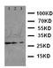 Fas Associated Via Death Domain antibody, LS-C312625, Lifespan Biosciences, Western Blot image 