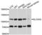 Electrogenic sodium bicarbonate cotransporter 4 antibody, PA5-76566, Invitrogen Antibodies, Western Blot image 