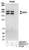 SWI/SNF Related, Matrix Associated, Actin Dependent Regulator Of Chromatin, Subfamily A, Member 4 antibody, A303-877A, Bethyl Labs, Immunoprecipitation image 