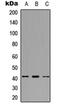 Serologically defined colon cancer antigen 8 antibody, orb304576, Biorbyt, Western Blot image 