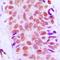 40S ribosomal protein S8 antibody, orb214543, Biorbyt, Immunohistochemistry paraffin image 