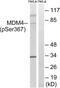 Protein Mdm4 antibody, LS-C199243, Lifespan Biosciences, Western Blot image 