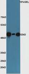 SUFU Negative Regulator Of Hedgehog Signaling antibody, orb158517, Biorbyt, Western Blot image 