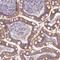 ArfGAP With Coiled-Coil, Ankyrin Repeat And PH Domains 3 antibody, HPA049317, Atlas Antibodies, Immunohistochemistry frozen image 