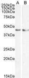 Kruppel Like Factor 15 antibody, TA302522, Origene, Western Blot image 