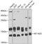 Mitochondrially Encoded NADH:Ubiquinone Oxidoreductase Core Subunit 3 antibody, 23-987, ProSci, Western Blot image 