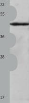 Keratin 23 antibody, TA321839, Origene, Western Blot image 