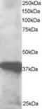 GIPC PDZ Domain Containing Family Member 3 antibody, TA302909, Origene, Western Blot image 