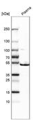 ST3 Beta-Galactoside Alpha-2,3-Sialyltransferase 1 antibody, NBP1-87045, Novus Biologicals, Western Blot image 