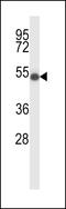 Zinc Finger DHHC-Type Containing 16 antibody, LS-C160751, Lifespan Biosciences, Western Blot image 