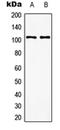 Glutamate Metabotropic Receptor 8 antibody, orb214016, Biorbyt, Western Blot image 