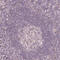 Hyaluronidase 1 antibody, HPA002112, Atlas Antibodies, Immunohistochemistry paraffin image 