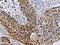 MAGE Family Member A10 antibody, CSB-PA956333, Cusabio, Immunohistochemistry paraffin image 
