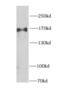 Cytoplasmic Linker Associated Protein 1 antibody, FNab01730, FineTest, Western Blot image 