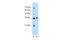 Dimethyladenosine transferase 1, mitochondrial antibody, 28-119, ProSci, Western Blot image 