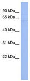 UPF3A Regulator Of Nonsense Mediated MRNA Decay antibody, TA343923, Origene, Western Blot image 