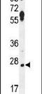 Leucine Rich Repeat Containing 57 antibody, PA5-24038, Invitrogen Antibodies, Western Blot image 