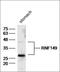 Ring Finger Protein 149 antibody, orb2719, Biorbyt, Western Blot image 