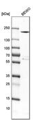 Collagen Type XVII Alpha 1 Chain antibody, PA5-60461, Invitrogen Antibodies, Western Blot image 