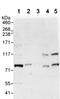 Cullin-4A antibody, ab72548, Abcam, Western Blot image 