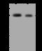 RNA Polymerase III Subunit B antibody, 204412-T40, Sino Biological, Western Blot image 