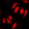 HsMAD2 antibody, GTX54987, GeneTex, Immunocytochemistry image 