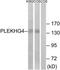 Pleckstrin Homology And RhoGEF Domain Containing G4 antibody, TA315294, Origene, Western Blot image 