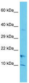 Cytochrome C Oxidase Assembly Factor 1 Homolog antibody, TA330693, Origene, Western Blot image 