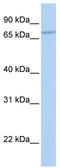 Coenzyme Q8A antibody, TA346630, Origene, Western Blot image 