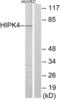Homeodomain Interacting Protein Kinase 4 antibody, LS-C119147, Lifespan Biosciences, Western Blot image 