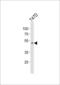 Hoxa-10 antibody, LS-C164972, Lifespan Biosciences, Western Blot image 