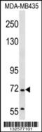 Grainyhead Like Transcription Factor 2 antibody, 56-882, ProSci, Western Blot image 