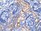 Phosphoenolpyruvate carboxylase antibody, ab28455, Abcam, Immunohistochemistry paraffin image 