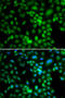 Synaptonemal Complex Central Element Protein 1 antibody, 22-791, ProSci, Immunofluorescence image 