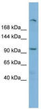 HECT And RLD Domain Containing E3 Ubiquitin Protein Ligase 4 antibody, TA330458, Origene, Western Blot image 