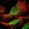 Chikungunya Virus antibody, NBP1-81732, Novus Biologicals, Immunofluorescence image 