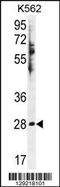 Hydroxysteroid 11-Beta Dehydrogenase 1 Like antibody, TA324404, Origene, Western Blot image 