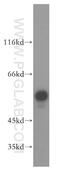 FKBP Prolyl Isomerase 8 antibody, 11173-1-AP, Proteintech Group, Western Blot image 