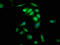 Protein Tyrosine Phosphatase 4A2 antibody, LS-C673528, Lifespan Biosciences, Immunofluorescence image 