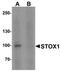 Storkhead Box 1 antibody, TA319084, Origene, Western Blot image 