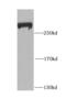 GBF1 antibody, FNab03372, FineTest, Western Blot image 