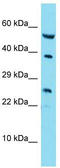 Putative Ras-related protein Rab-42 antibody, TA334069, Origene, Western Blot image 