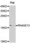 Ribonuclease A Family Member 13 (Inactive) antibody, orb48992, Biorbyt, Western Blot image 